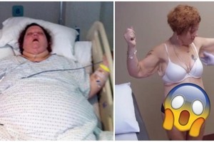 444公斤女子「胖到送醫急救」，成功狂鏟300公斤「現在模樣卻讓她超後悔」：寧願胖回去！