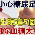 醫生告誡：腳上出現這5個癥狀，說明你「血糖太高」了！小心「糖尿足」