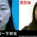 大陸女子豪砸15萬整形…術後堅決不付錢！網友一看「前後對比圖」全笑噴：不付錢 是對的