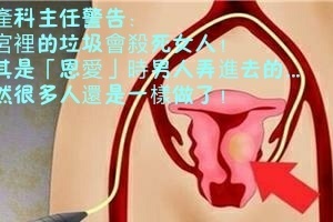 婦產科主任警告：子宮裡的垃圾會殺死女人！尤其是「恩愛」時男人弄進去的...竟然很多人還是做了！