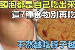 「大頸泡」都是自己吃出來的，這7種食物別再吃了，不然越吃脖子越腫