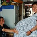 孕婦懷了五胞胎，肚子大得離譜，當孩子出生後…醫生看到性別嚇了一大跳！