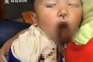 筷子插進嘴巴＋眼眶…1歲半童滿臉鮮血　媽：嚇到腿軟