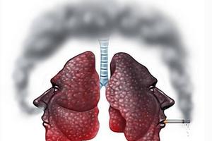 吸煙者：能完成3個小測試，沒有三大身體症狀，說明你的肺還挺好