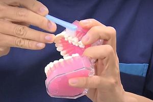 牙籤式刷牙法 預防牙周病