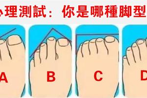心理測試：你是圖中哪種腳型？測出你的福氣和好命！