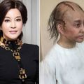 美魔女「毀容禿頂」變咕嚕　嚇死人！