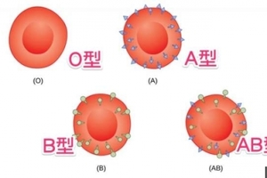 原來得病跟血型也有關！什麼血型要注意什麼健康隱患，非常重要！千萬要注意！