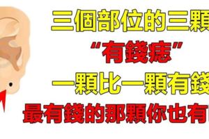 你也有這3顆有錢痣嗎？一顆比一顆有錢，猜猜最有錢的那顆痣會在哪裡呢？