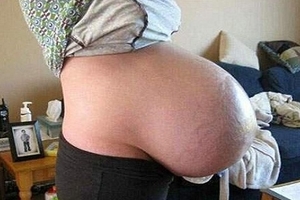 這女人整整懷孕「4年」...每家醫院卻都拒收，原來她肚子裡懷的竟然是...