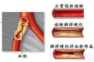 下面每一種食物 ，都是血液垃圾的天敵看完不要驚訝！尤其是三十歲以後還不吃就晚了......絕對要早點知道！！