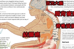 嚇！「久坐」竟比吸菸更致命！！拚命運動也救不了你！只要這樣做，立即預防「久坐癌」！一定要分享出去！