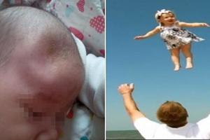 6個月大的寶寶全身10多處骨折，醫生憤怒了！曾經做過「這5個動作」的家長都會要孩子的命！