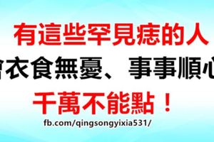 有這些罕見痣的人，會衣食無憂、事事順心，千萬不能點！