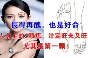 「沒有醜女人，只有苦命女人」女人身上長有這5顆痣，註定你是富貴命！尤其是第一顆，非常少見！