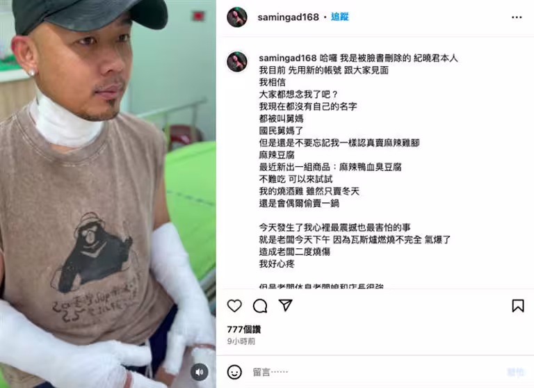 紀曉君透露老公因瓦斯氣爆而受傷,PO出傷勢照直呼「好心疼」。(圖/翻攝自IG) 紀曉君透露老公因瓦斯氣爆而受傷,PO出傷勢照直呼「好心疼」。(圖/翻攝自IG)