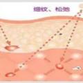 別傻了，化妝品不能給你天然柔嫩無暇的「寶寶肌」！