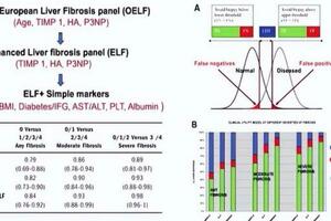 尤紅教授：肝纖維化的無創診斷進展