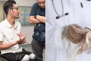 工程師只是去割盲腸…醒來「雙腿被截肢」崩潰痛哭！醫院解釋超離譜