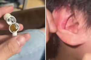 戴中國熱銷藍牙耳機　突在男大生耳內爆炸！專家揭真相了