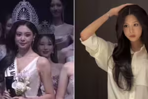父親是男神！23歲最美星二代奪選美冠軍　遭挖「童年舊照」網愣：該頒獎給整形醫生