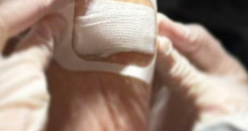 楊謹華被「木頭插腳底」送急診 掩面蜷曲病床畫面曝光