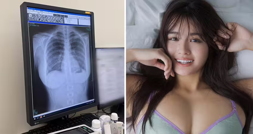寫真偶像炫耀「我的肺很乾淨！」　網看X光全歪樓：太刺激了