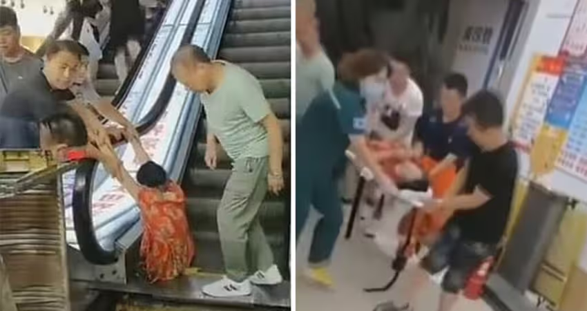 手扶梯「吃人」！大媽雙腳被絞進縫隙