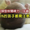 寶寶的頭型攸關視力、牙齒、聽力～50%的孩子都需注意！