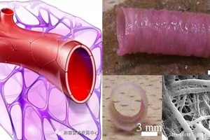 讓「血管」瞬間年輕隻要吃下他們....！人體血液骯髒，就會加速變老變醜！不是恐嚇你，千萬要注意！