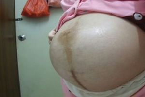 懷孕不到7個月，孕婦的肚子卻大得驚人，超音波圖像把他們嚇壞了！寶寶竟然...