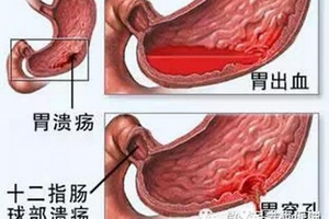 胃不好的如何養胃，正所謂“三分治七分養”，養胃秘訣都幫你收集好了～不看是自己的損失！