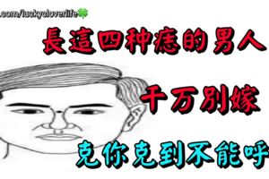 長這四種痣的男人，千萬別嫁！克你克到不能呼吸