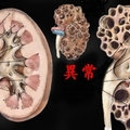 醫生叮嚀改掉這「7種習慣」他不聽，結果「腎臟」爛到不能再爛，連洗腎都沒救！快看你有沒有？！