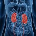 慢性腎炎嚴重嗎？怎麼就變成了尿毒症？