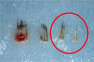 「鼻毛」都炸開了能拔嗎？終於有解！你一個舉動的決定都會影響你一輩子！做錯了就慘了...