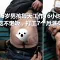 15歲男孩每天工作16小時，吃不飽飯，打工7個月滿身都是傷