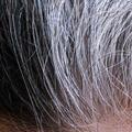 為啥白頭髮越長越多？你以為是老了，醫生：和這幾大方面也有關！