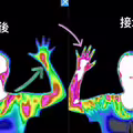 沒吃藥！長期手痛「1動作」減少發炎　半小時效果醫驚喜