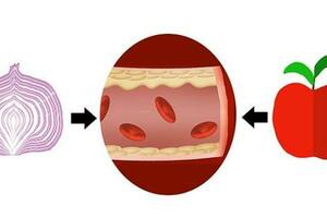 騙了國人30年的「軟化血管」偏方，什麼洋蔥、紅酒、木耳，胡扯