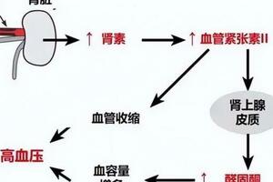 腎性高血壓丨腎病最重要、最常見、最早出現的併發症