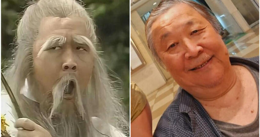 78歲「金庸老頑童」一個月跌2次雙腿發黑 被查出心臟有毛病