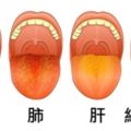 現在伸出你的舌頭就能快速檢測「身體哪裡有毛病」，紫色舌頭的疾病實在太糟糕了！