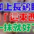 腳上長雞眼，用「這東西」只要一抹就好，超神奇！好方法一定要分享出去！！