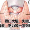 甲亢患者到底能吃什麼？看了真心······