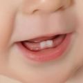寶寶長乳牙的四種痛，父母不注意，寶寶容易長齲齒