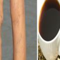 小腿出現3大症狀，說明血管動脈硬化嚴重，不想雙腿報廢就看過來