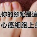 如果你的「腳趾」是這樣的,當心「癌細胞」上身！仔細看，別晚了！