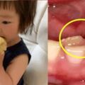醫生建議：別這樣給娃吃水果，真的對牙不好