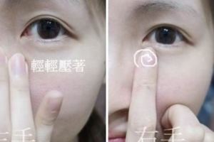 女明星為什麼看不出來有眼袋，其實你也可以做到